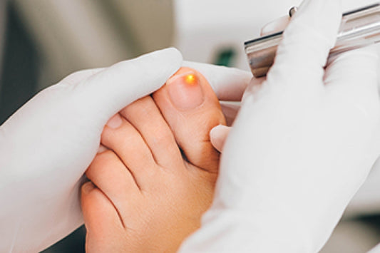 Toe Nail Fungus Removal