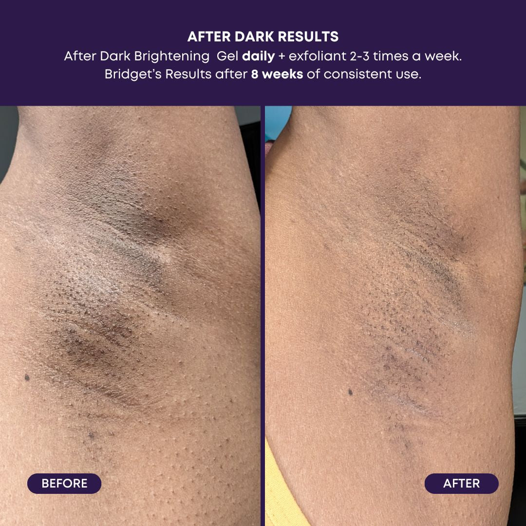 BUSHBALM - After Dark Brightening Gel (3% TXA | 2% Niacinamide)