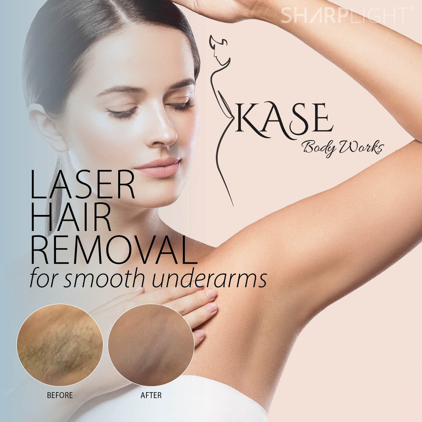Upper Body Laser Hair Reduction