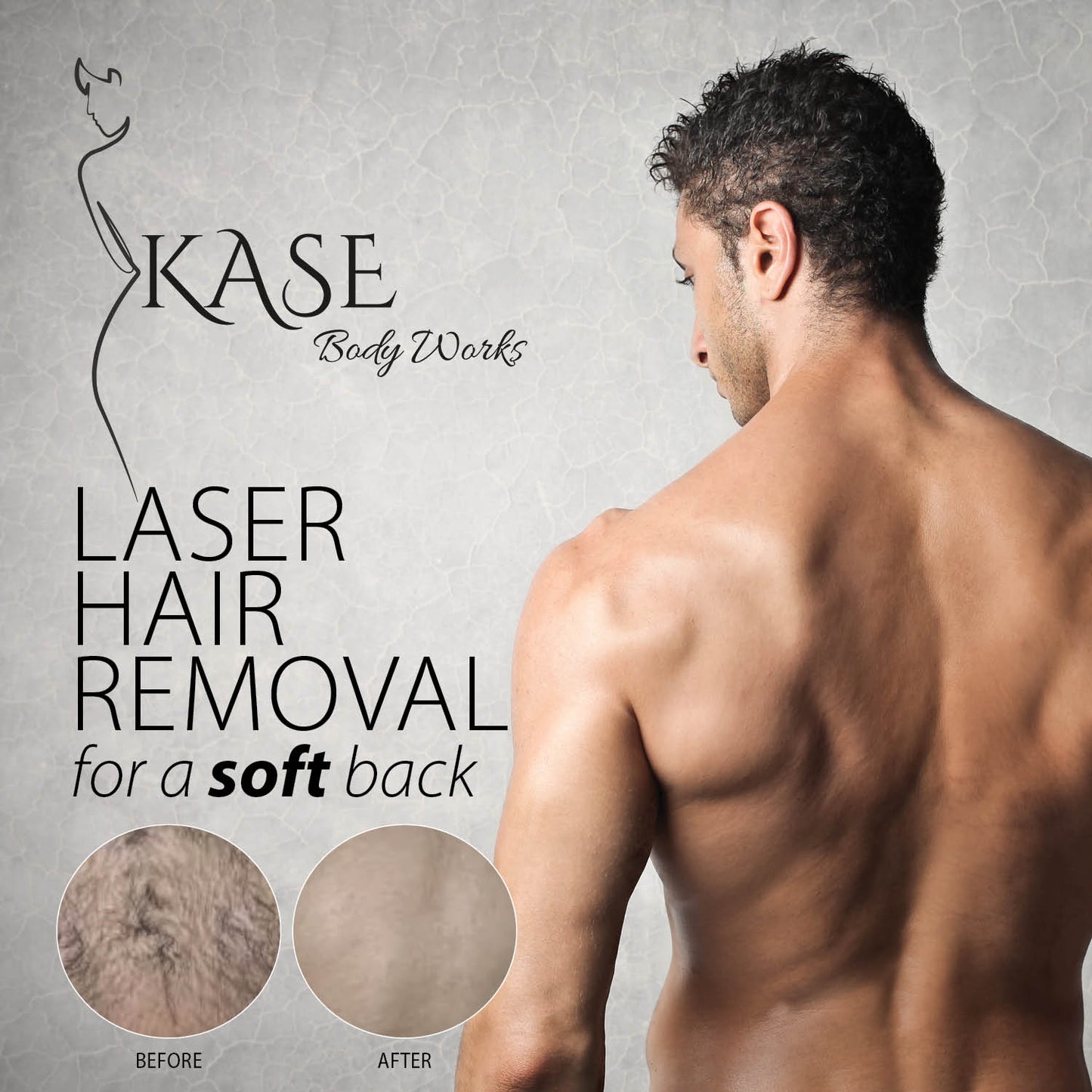 Men’s Laser Hair Reduction Packages