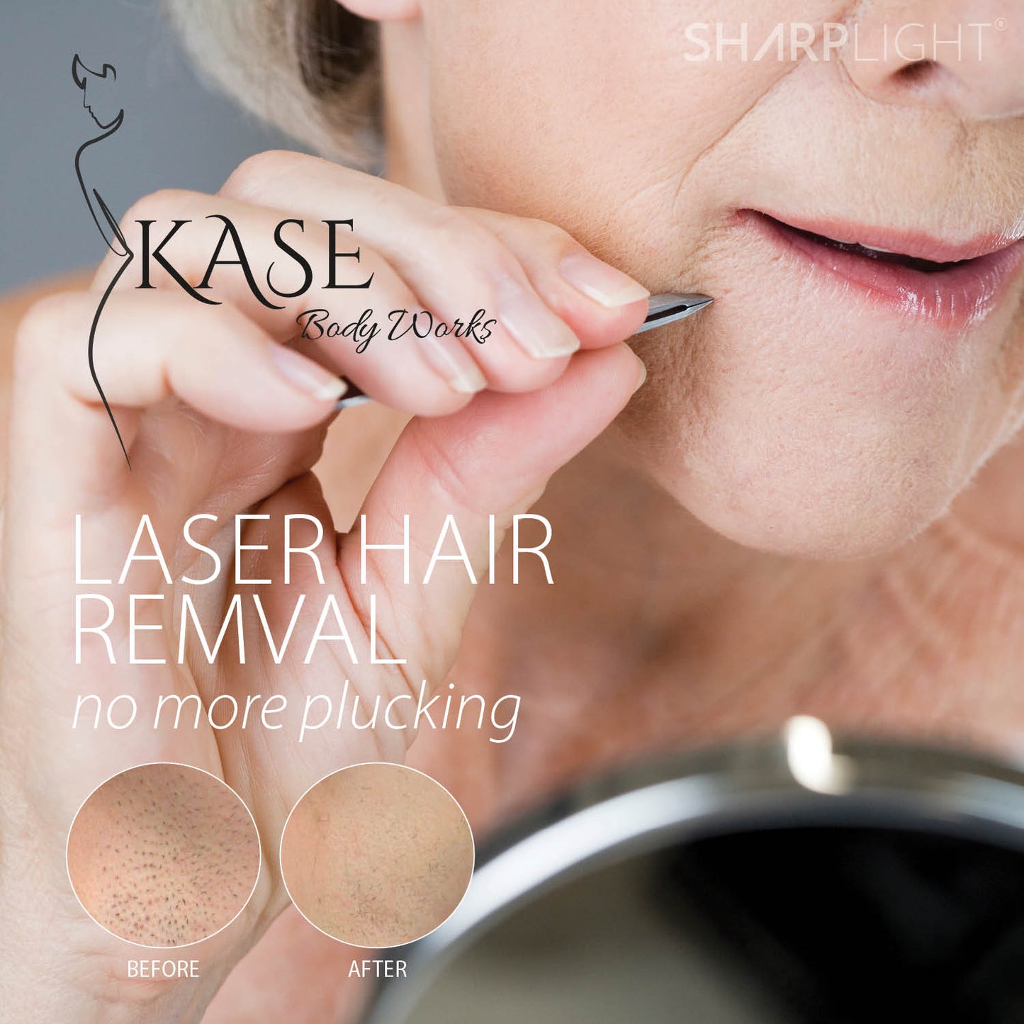 Facial Laser Hair Reduction