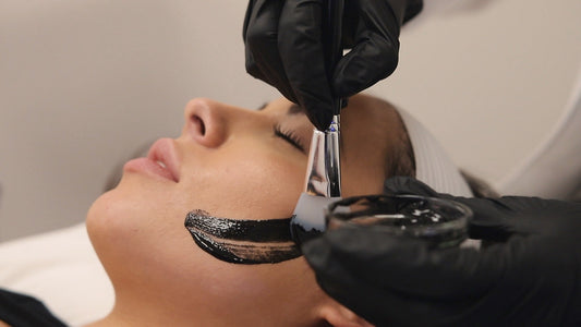 💥 NEW SERVICE ALERT: Hollywood Carbon Facial — Now 50% OFF!