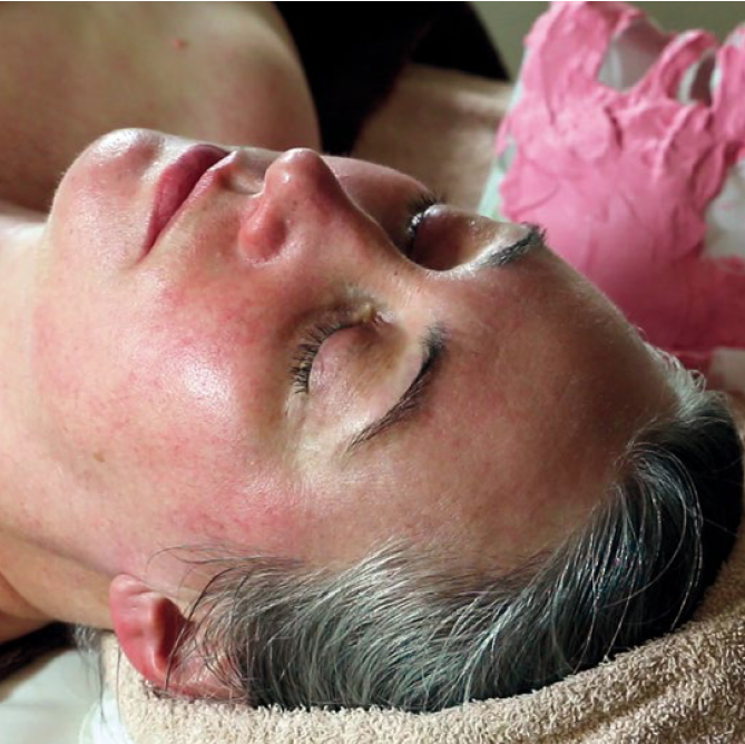 Pevonia RS2 Facial for Rosacea & Sensitive Skin