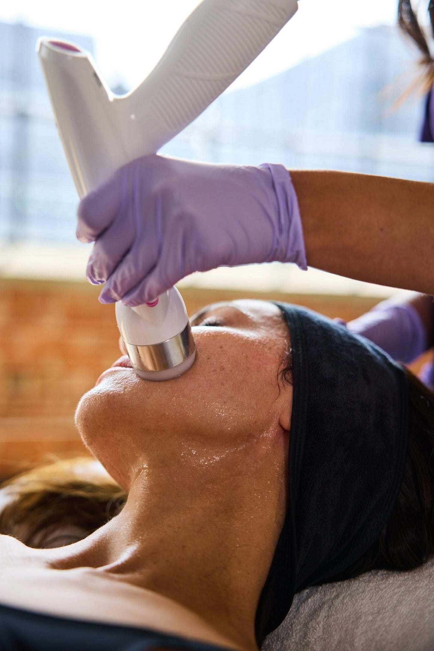 Facial Laser Hair Reduction