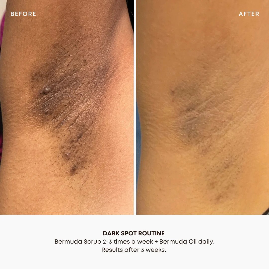 BUSHBALM - Bermuda Dark Spot Oil