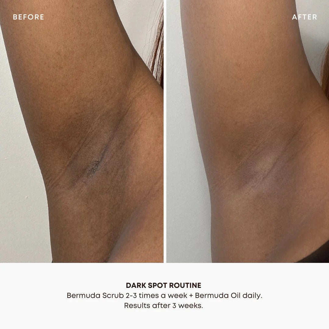 BUSHBALM - Bermuda Dark Spot Oil