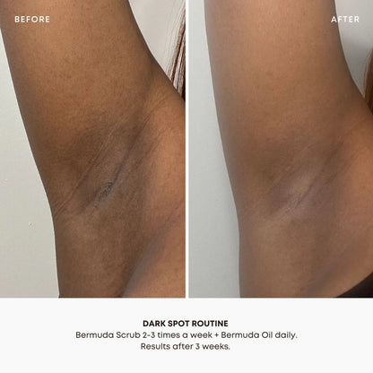 BUSHBALM - Bermuda Dark Spot Oil