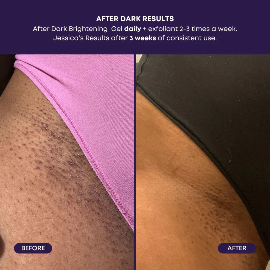 BUSHBALM - After Dark Brightening Gel (3% TXA | 2% Niacinamide)