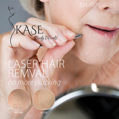 Facial Laser Hair Reduction