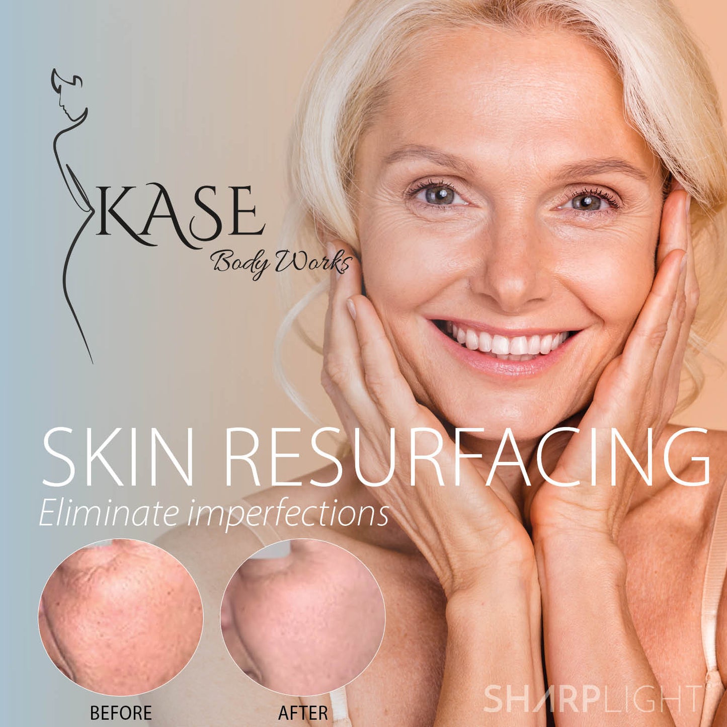 Facial Resurfacing Treatments