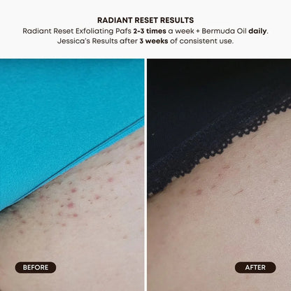 BUSHBALM - Radiant Reset Exfoliating Toner Pads
