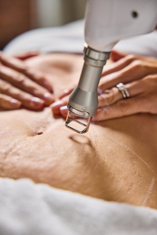 Fractional Scaring and Resurfacing