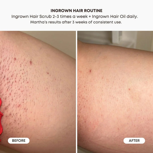 BUSHBALM - Sugar Cookie Ingrown Hair Oil