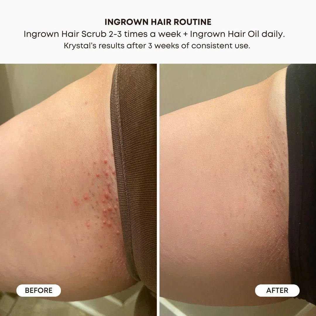 BUSHBALM - Sugar Cookie Ingrown Hair Oil