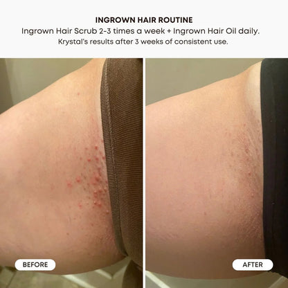 BUSHBALM - Sugar Cookie Ingrown Hair Oil